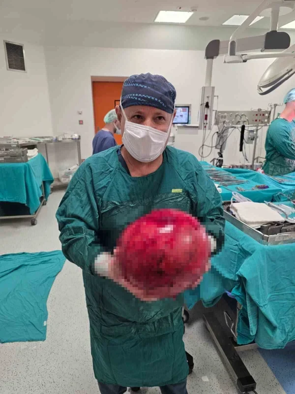 Kocaeli'de 6,5 kiloluk böbrek tümörü ameliyatla alındı