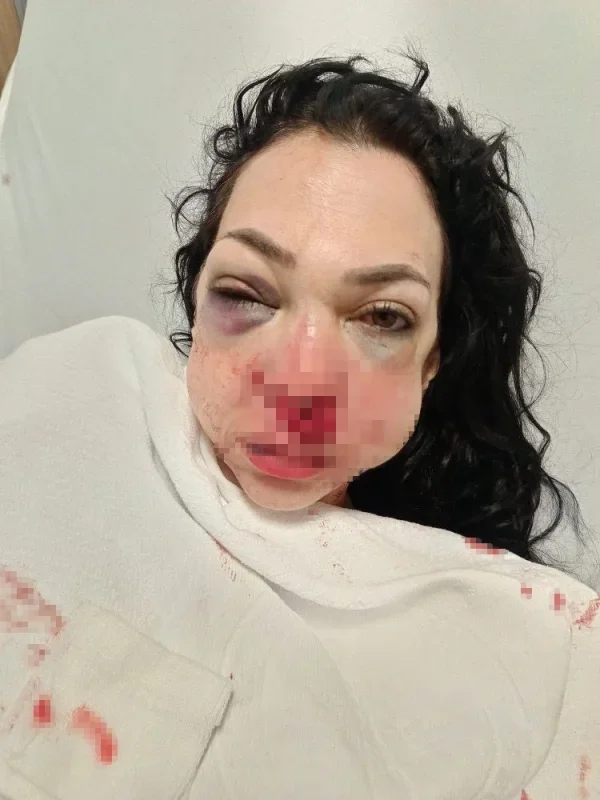İzmit'te kafede anne ve oğluna saldırı davasında ilk duruşma
