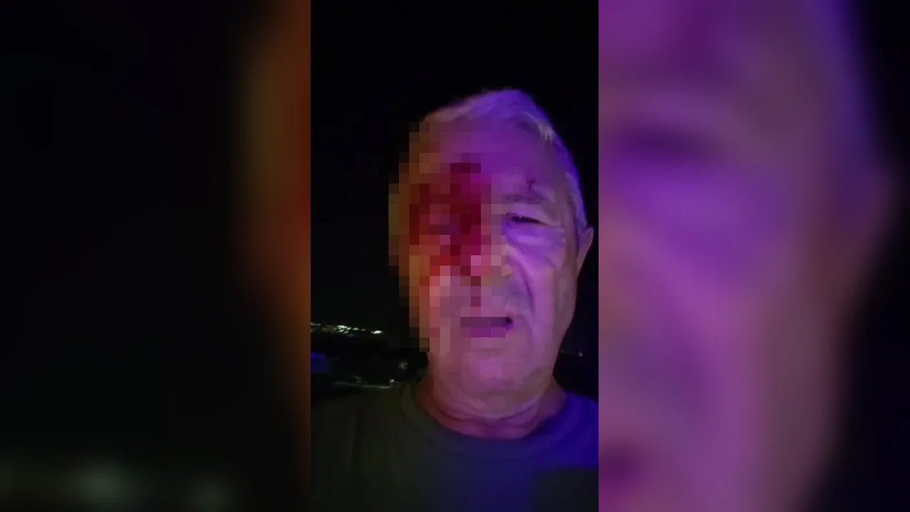 Kocaeli'de saldırıya uğrayan muhabir Tayyar Öztoprak yaralandı